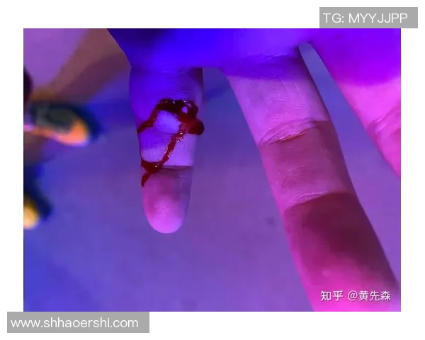 手打篮球时被戳了该如何处理和预防受伤的有效方法与建议 手打篮球时被戳了该如何处理和预防受伤的有效方法与建议